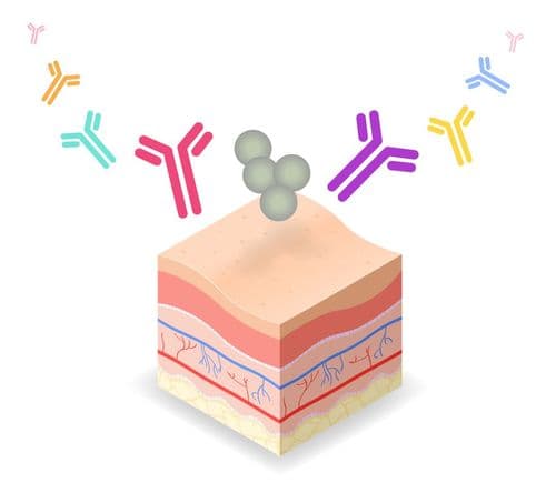 CMEswiper: Swiping for Solutions: IL-13 and the Modern Management of Atopic Dermatitis: An Online Activity