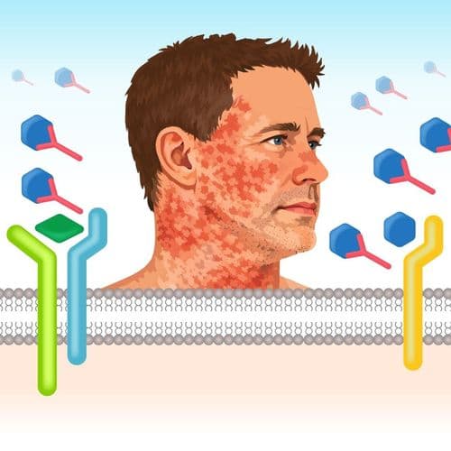 CMEswiper: Swipe & Solve Treatment Challenges in Head & Neck Atopic Dermatitis: An Online Activity