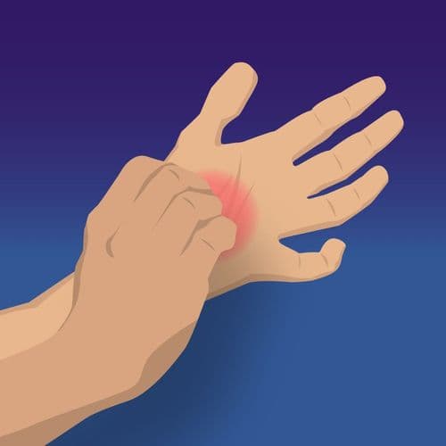 CMEswiper: Assessing the Hand You’re Dealt: Swiping Through Severity Scores in Chronic Hand Eczema: An Online Activity